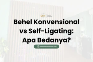 Behel Konvensional vs Self-Ligating: Apa Bedanya? - DX Dental Aesthetic