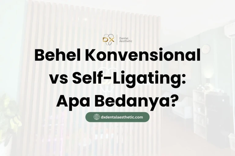 Behel Konvensional vs Self-Ligating: Apa Bedanya? - DX Dental Aesthetic