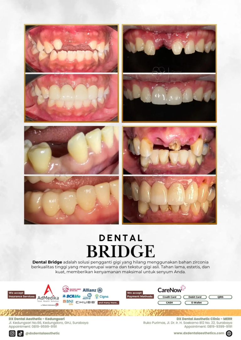 Katalog Treatment - DX Dental Aesthetic 04