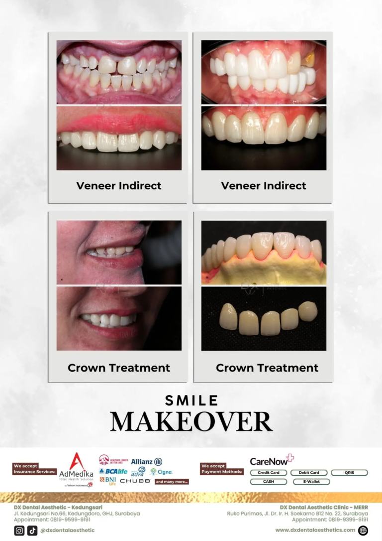 Katalog Treatment - DX Dental Aesthetic 07