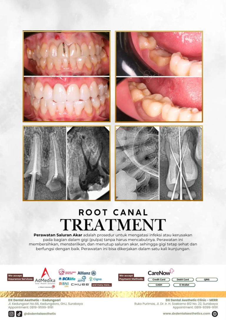 Katalog Treatment - DX Dental Aesthetic 08