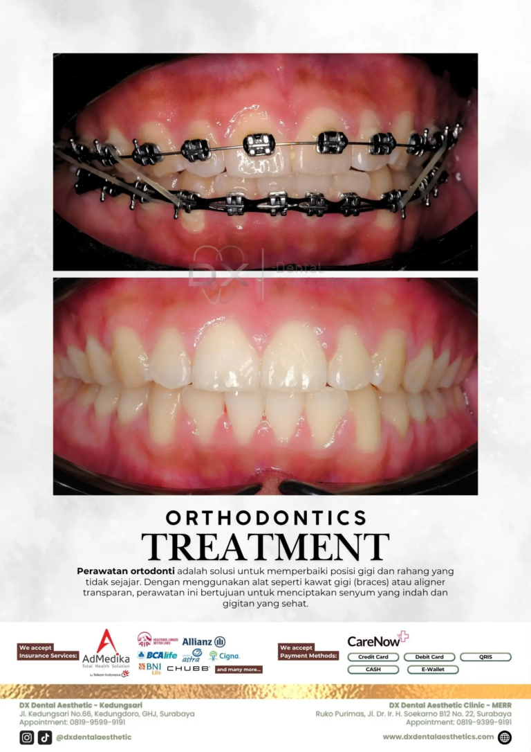 Katalog Treatment - DX Dental Aesthetic 09