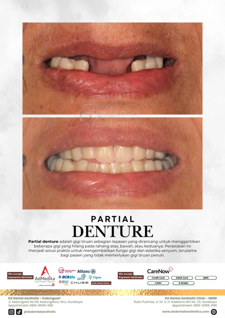 Katalog Treatment - DX Dental Aesthetic 11