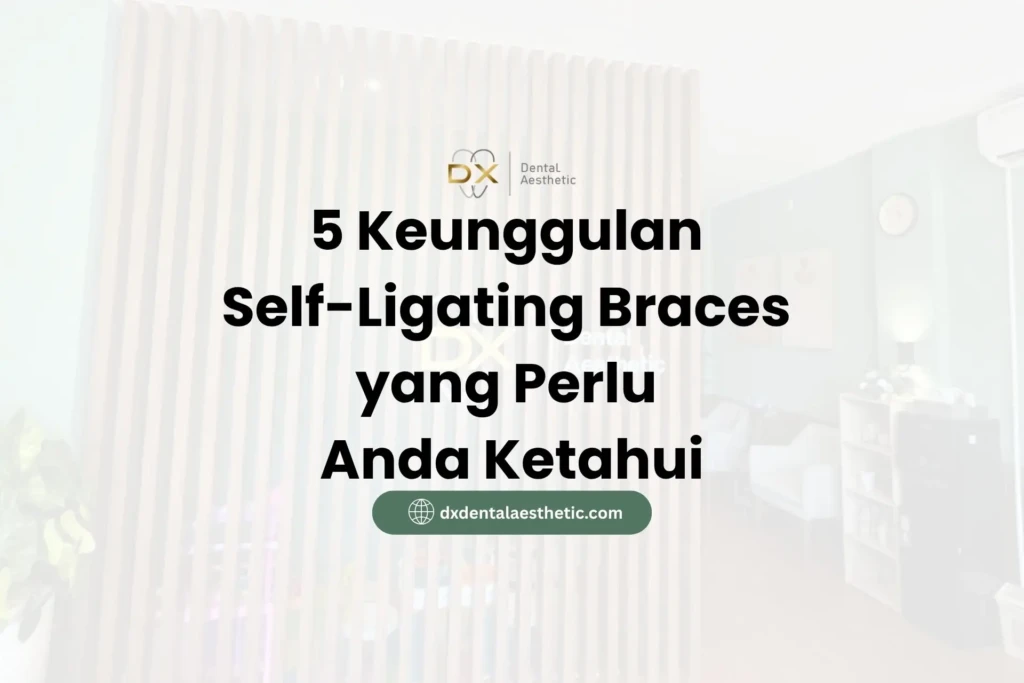 5 Keunggulan Self-Ligating Braces yang Perlu Anda Ketahui