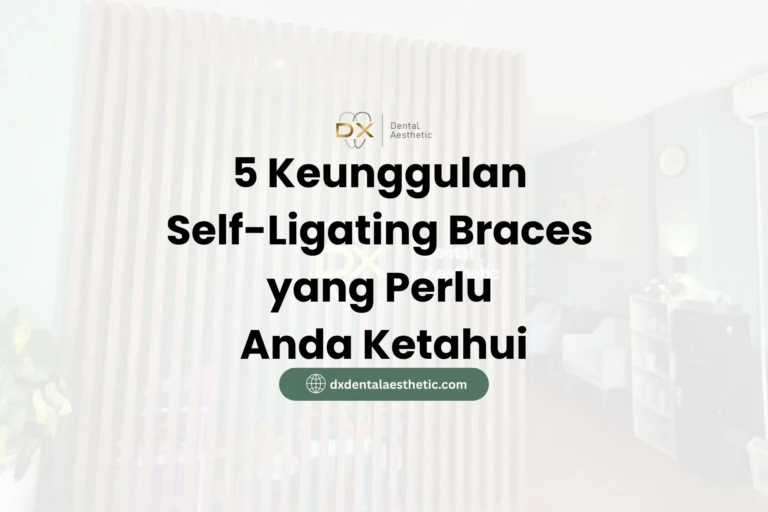 5 Keunggulan Self-Ligating Braces yang Perlu Anda Ketahui - DX Dental Aesthetic
