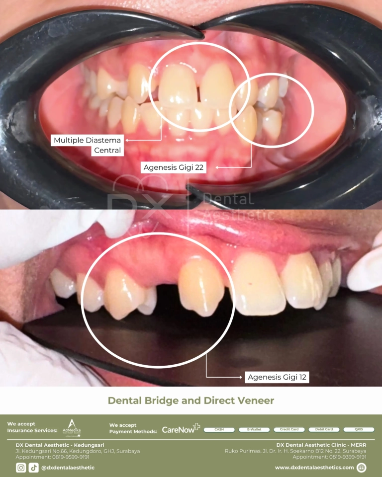Before After 10 - Dental Microscopes by Eighteeth - DX Dental Aesthetic