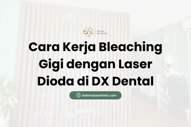Cara Kerja Bleaching Gigi dengan Laser Dioda di DX Dental Aesthetic