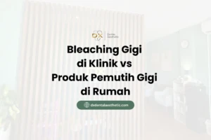 Bleaching Gigi di Klinik vs. Produk Pemutih Gigi di Rumah - DX Dental Aesthetic