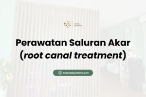 Perawatan Saluran Akar - DX Dental Aesthetic
