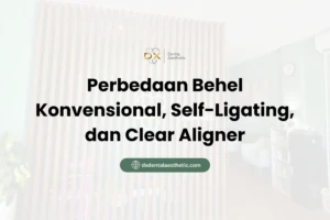 Perbedaan Behel Konvensional, Self-Ligating, dan Clear Aligner - DX Dental Aesthetic