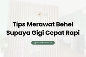 Tips Merawat Behel Supaya Gigi Cepat Rapi - DX Dental Aesthetic