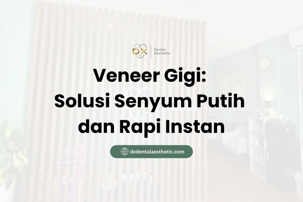 Veneer Gigi: Solusi Senyum Putih dan Rapi Instan