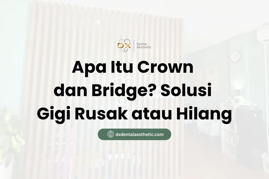 Apa Itu Crown dan Bridge? Solusi Gigi Rusak atau Hilang