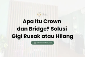 Apa Itu Crown dan Bridge? Solusi Gigi Rusak atau Hilang - DX Dental Aesthetic