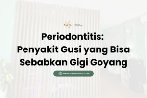 Periodontitis Penyakit Gusi yang Bisa Sebabkan Gigi Goyang - DX Dental Aesthetic