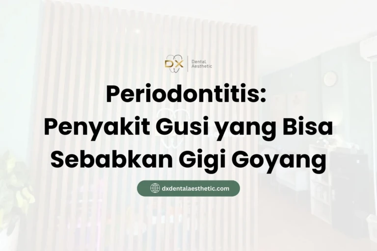 Periodontitis Penyakit Gusi yang Bisa Sebabkan Gigi Goyang - DX Dental Aesthetic