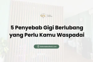 5 Penyebab Gigi Berlubang yang Perlu Kamu Waspadai - DX Dental Aesthetic