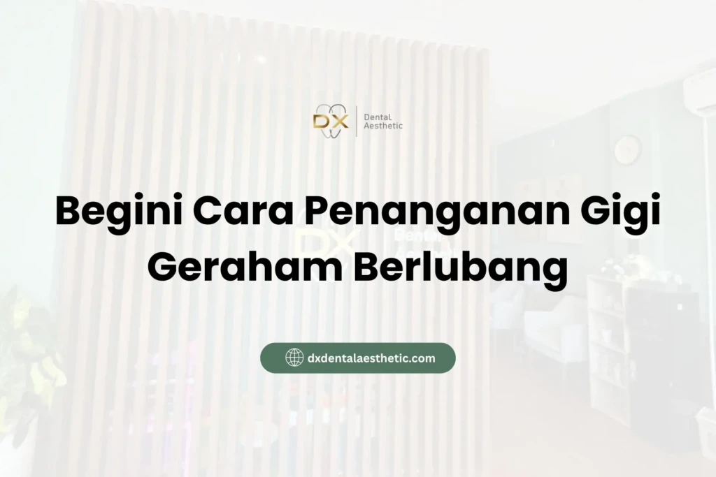 Begini Cara Penanganan Gigi Geraham Berlubang