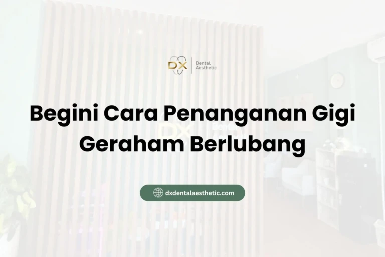 Begini Cara Penanganan Gigi Geraham Berlubang - DX Dental Aesthetic