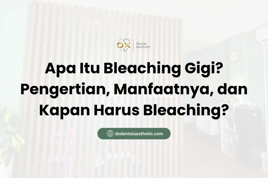 Apa Itu Bleaching Gigi? Pengertian, Manfaatnya, dan Kapan Harus Bleaching?