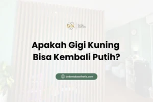 Apakah Gigi Kuning Bisa Kembali Putih? - DX Dental Aesthetic