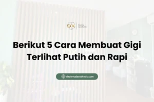 Berikut 5 Cara Membuat Gigi Terlihat Putih dan Rapi - DX Dental Aesthetic