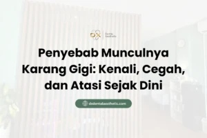 Penyebab Munculnya Karang Gigi Kenali, Cegah, dan Atasi Sejak Dini - DX Dental Aesthetic